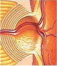 Диагностика и лечение глаукомы в волгограде thumbnail